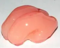 smooth brain 